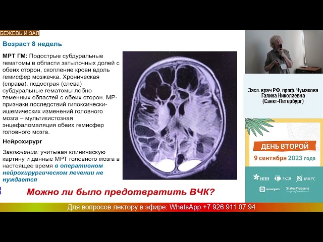 Засл. врач РФ, докт. мед. наук Чумакова Г.Н.